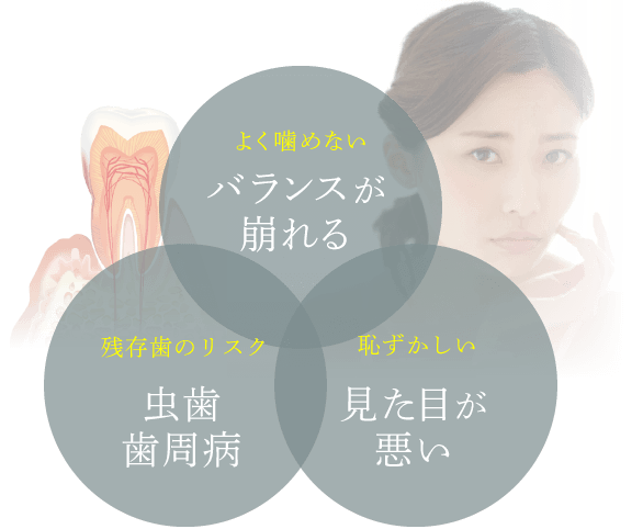 よく噛めない バランスが崩れる 残っている歯に悪影響 虫歯歯周病 恥ずかしい 見た目が悪い